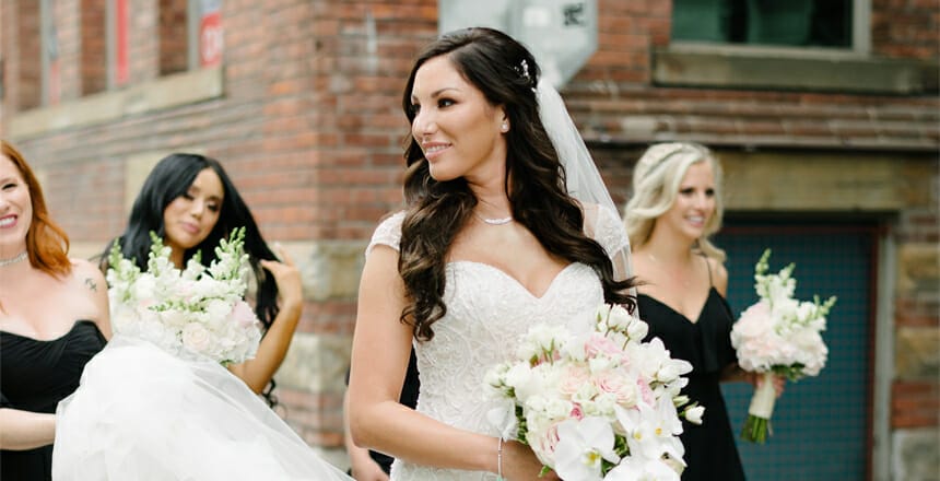 How soon before your wedding should you get cosmetic injectables?